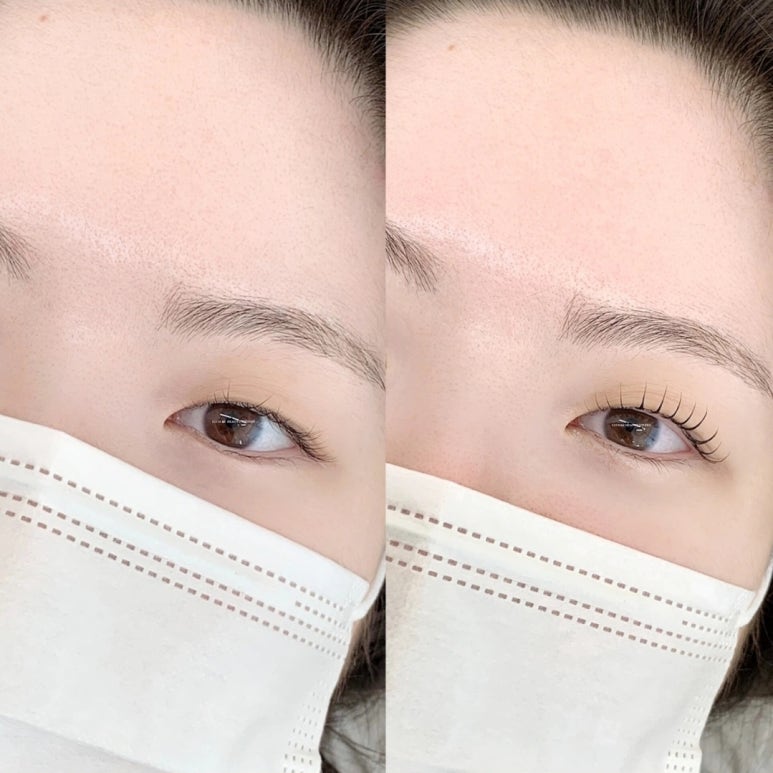 루채뷰티 이미지