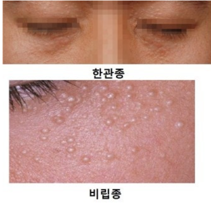 스파유(SPAU) 이미지