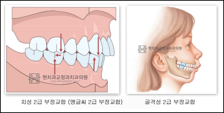 현치과교정과치과의원 이미지