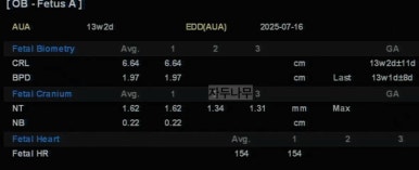후둥 이미지