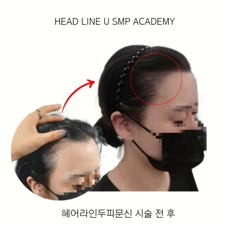 헤드라인유 이미지