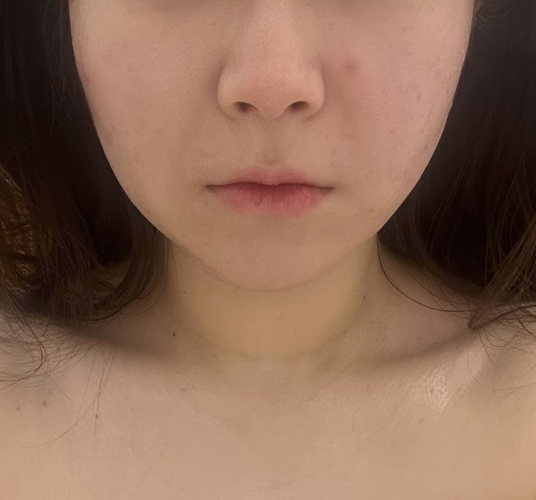 르미에스테틱 이미지