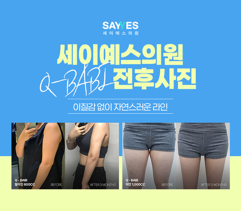 바비라인 이미지