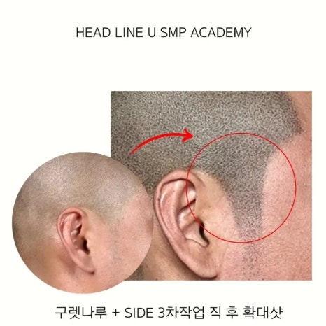 헤드라인유 이미지