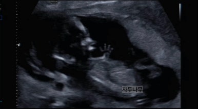 후둥 이미지
