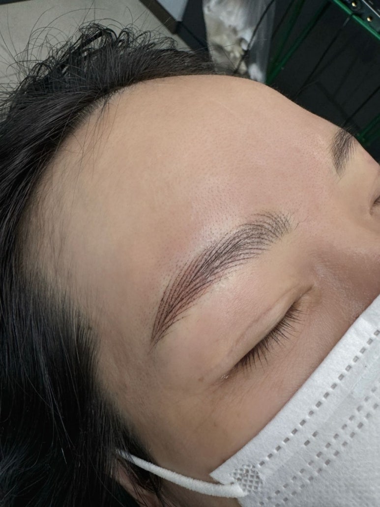 페리투에스테틱 이미지