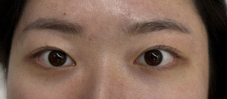 누벨르브로우 이미지
