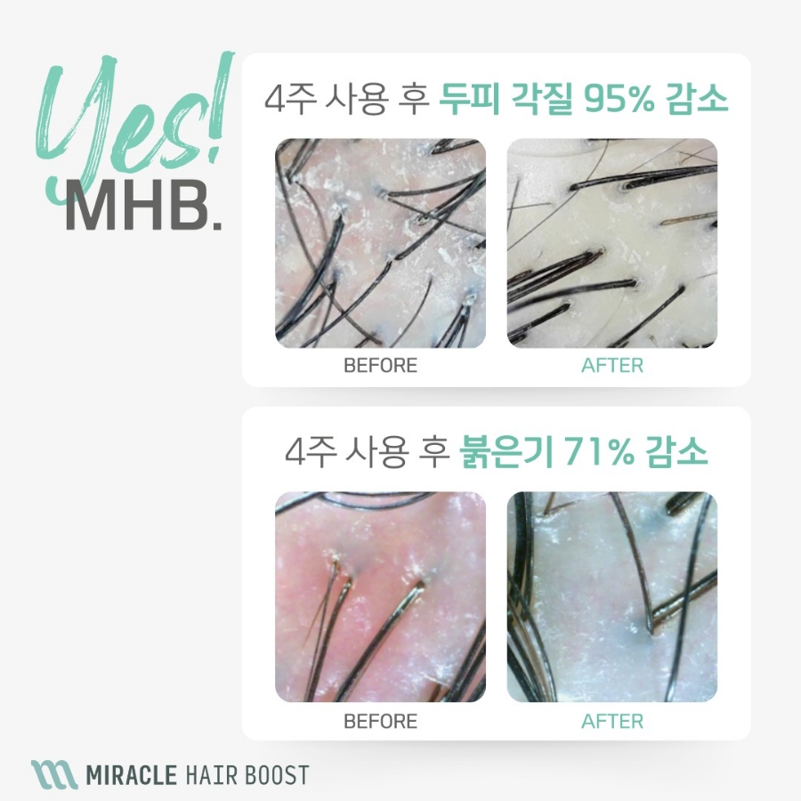 모재 이미지