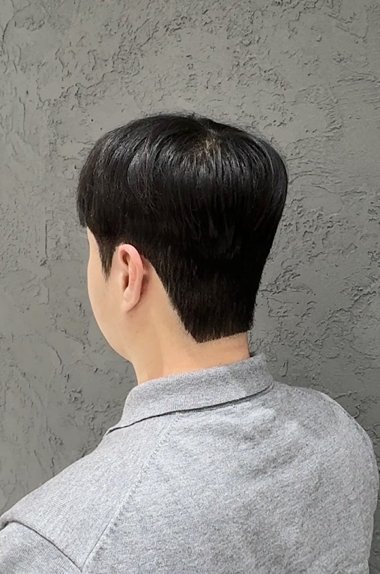 은지헤어라인 이미지
