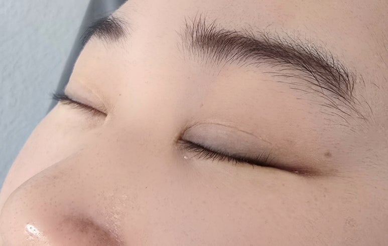 퍼펙트픽스 이미지