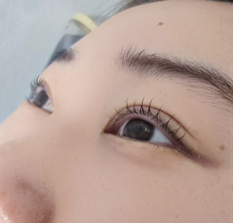 퍼펙트픽스 이미지