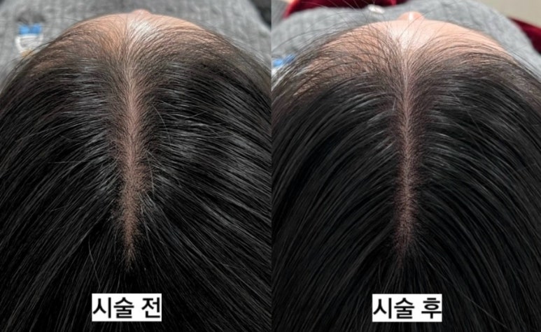 도트바이림 이미지