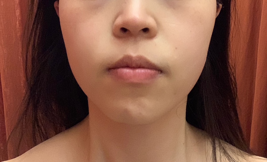 스킨바 수지성복점 이미지