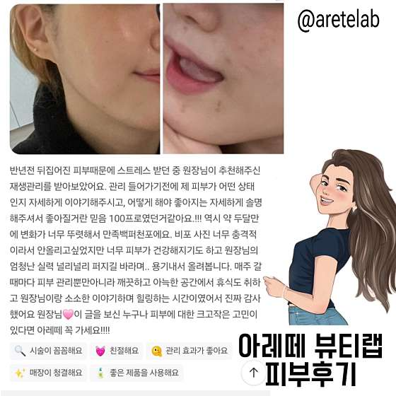 아레떼뷰티랩 이미지