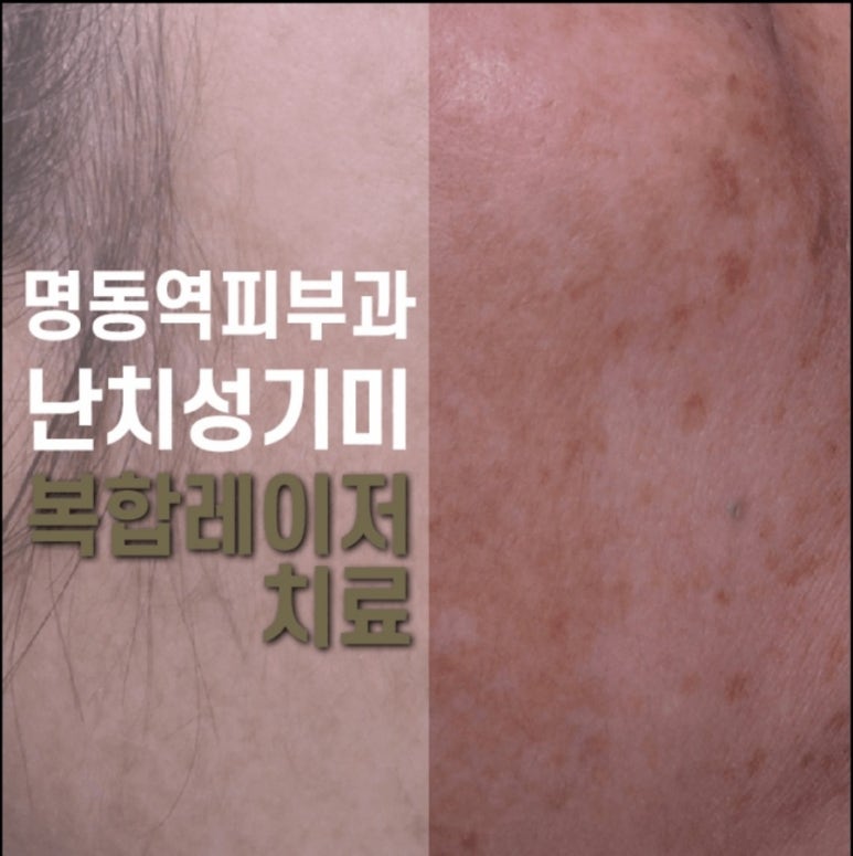 복피부과 이미지