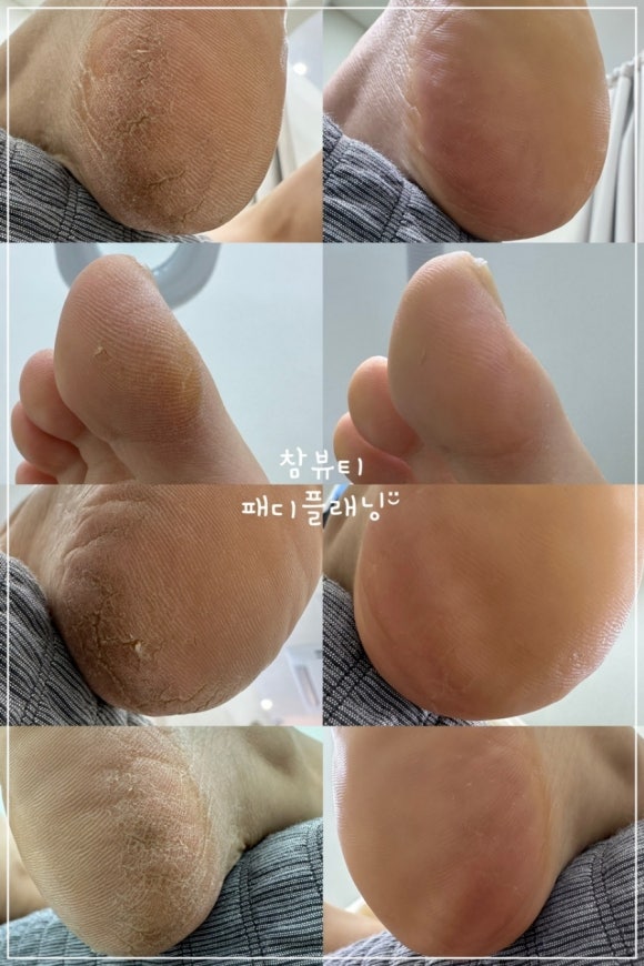 꼼꼼속눈썹 이미지