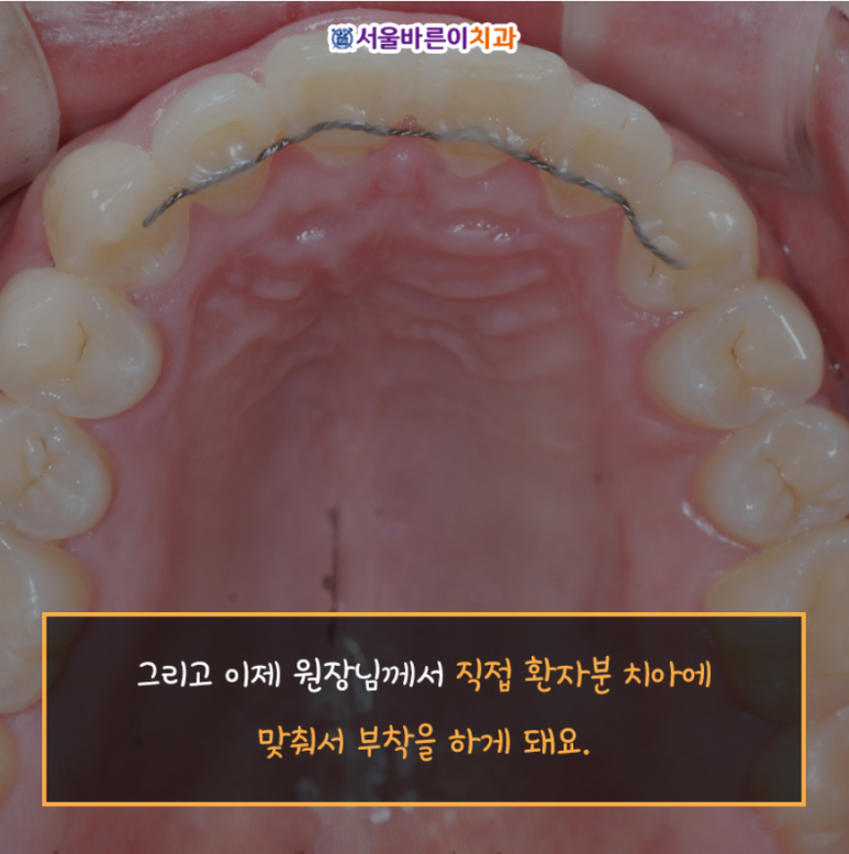 서울바른이치과의원 이미지