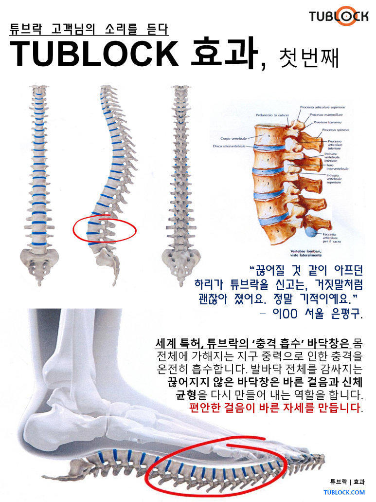 튜브락 이미지