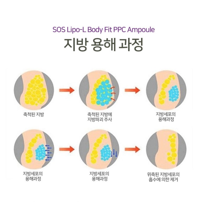 바디슬림미 이미지