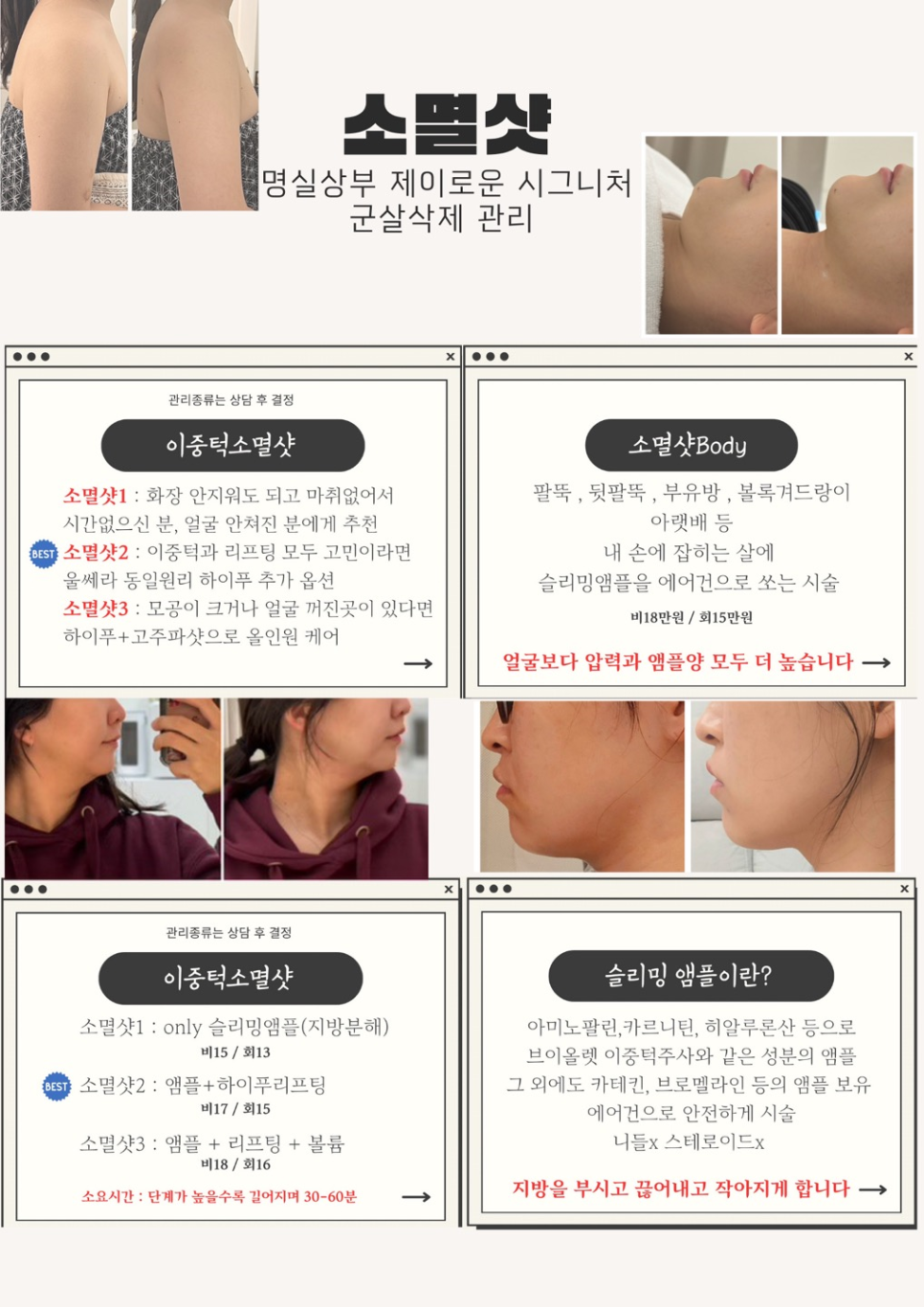 로우제이 이미지