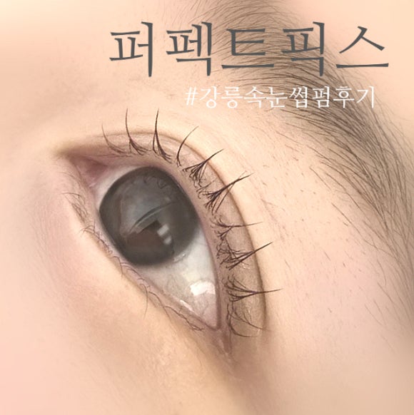 퍼펙트픽스 이미지
