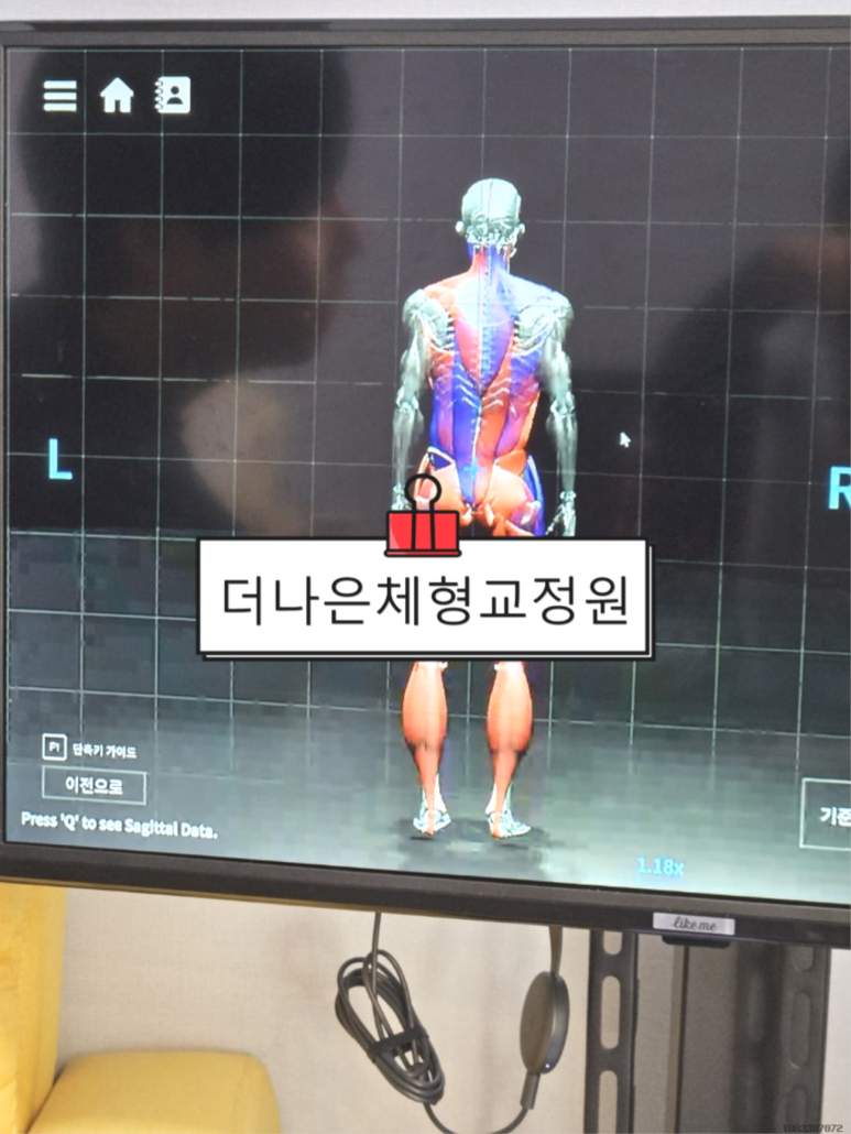 바른자세교정원 이미지