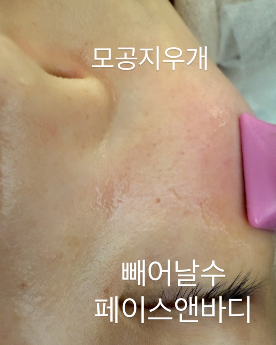 라인피부앤바디 이미지