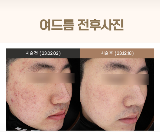 아그네스 이미지