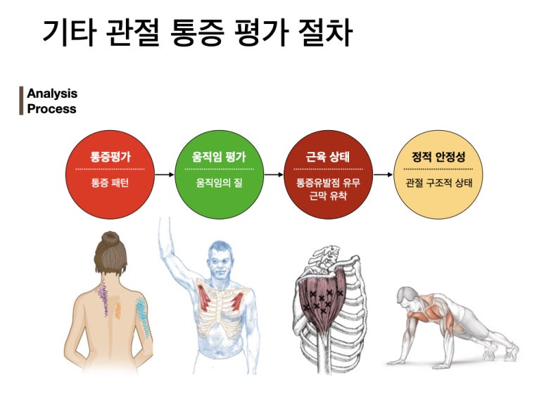 내리막길 심함 이미지