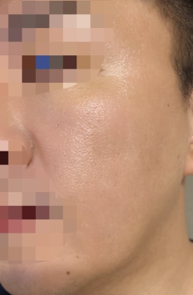 프로젝트유 이미지