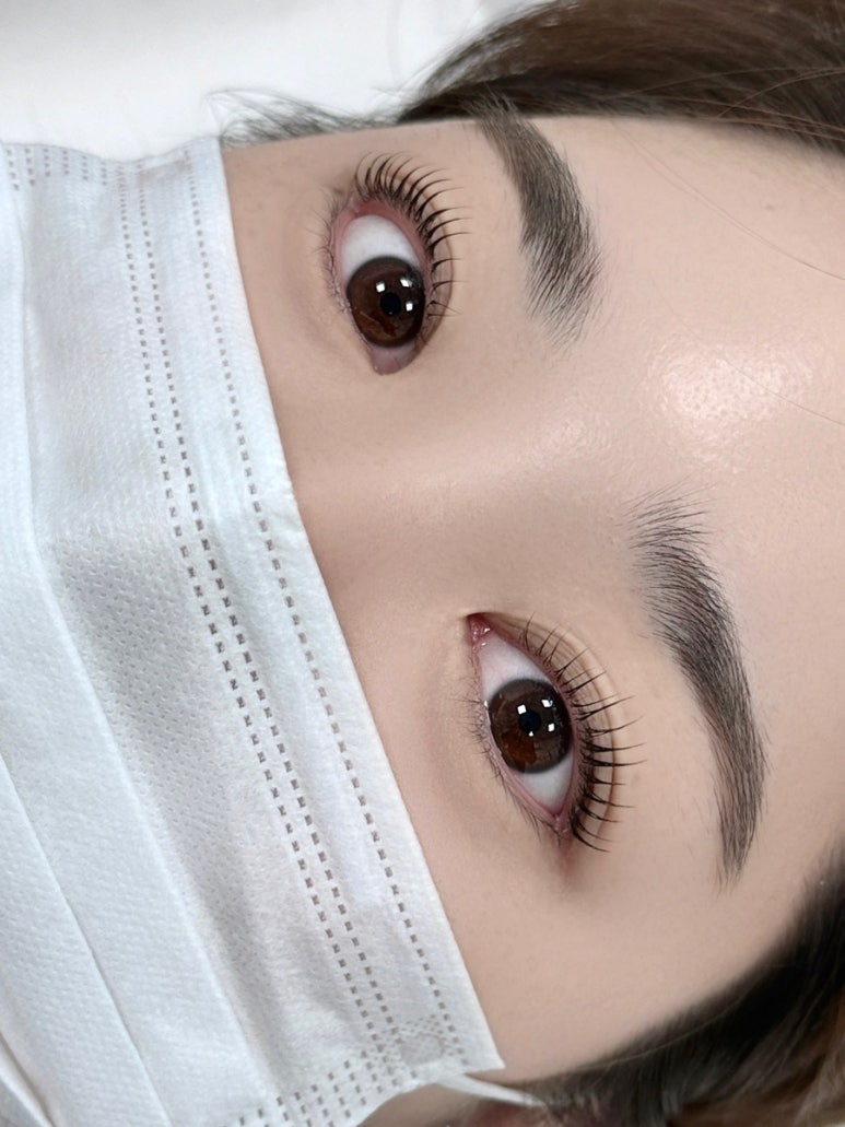 쏘뇨 이미지