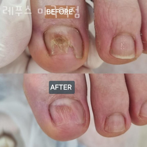 레푸스마곡 이미지