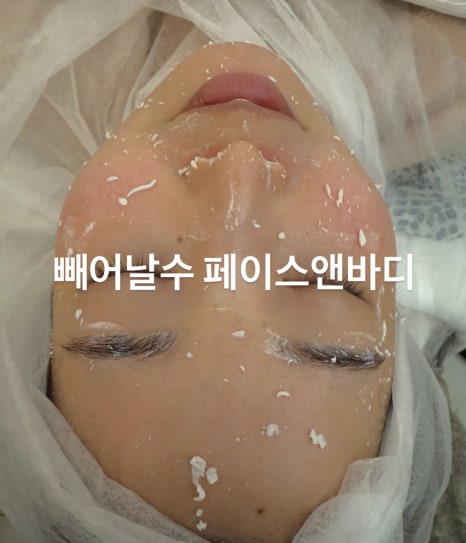라인피부앤바디 이미지