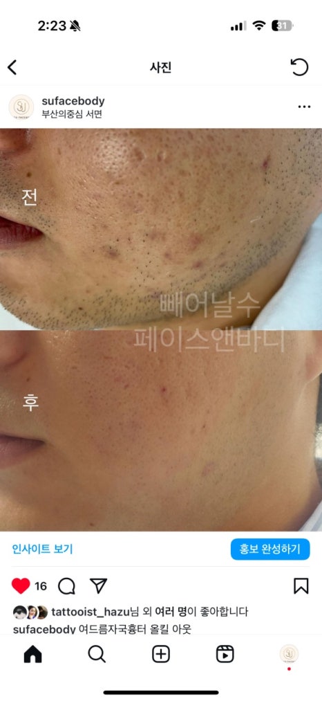 피부앤바디 이미지