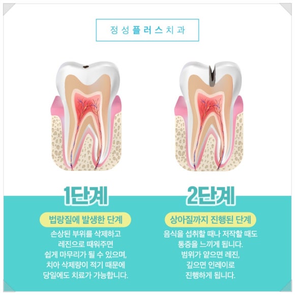 정성플러스치과 이미지
