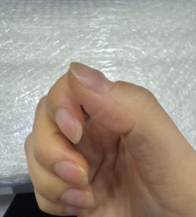 류이네일 이미지