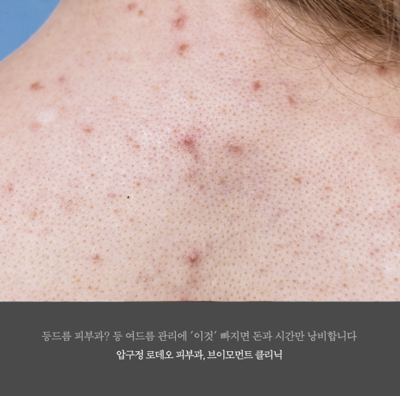 브이모먼트클리닉 이미지