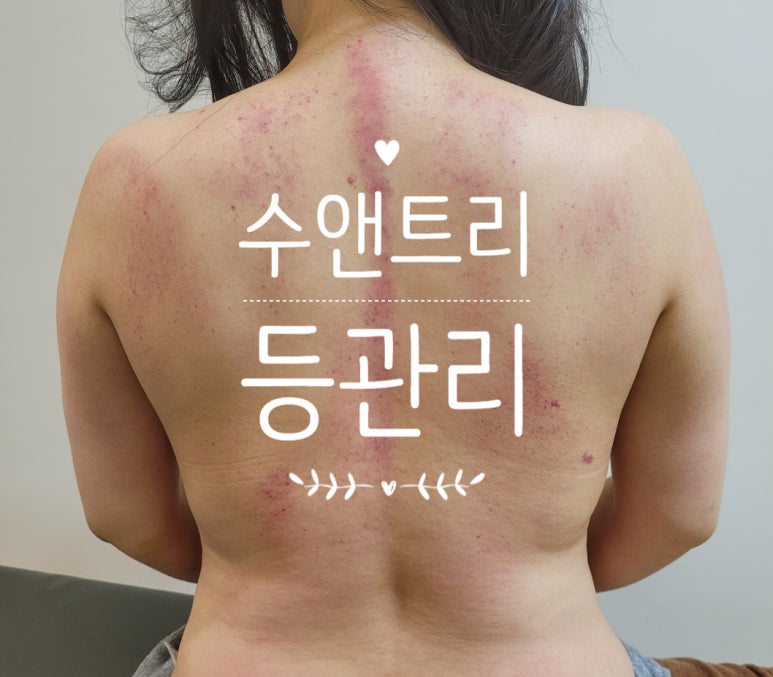 수앤테라피 이미지
