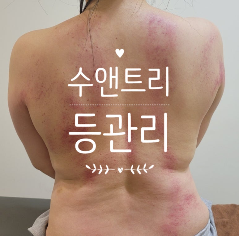 수앤테라피 이미지