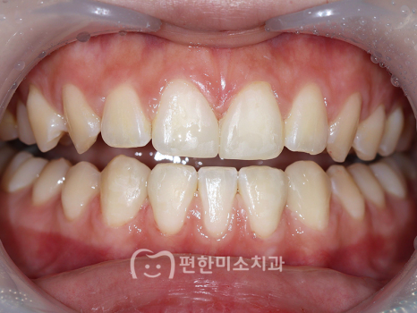편한기치과 이미지