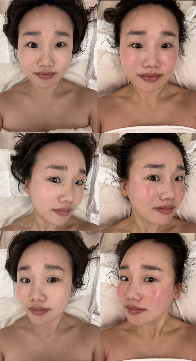르미에스테틱 이미지