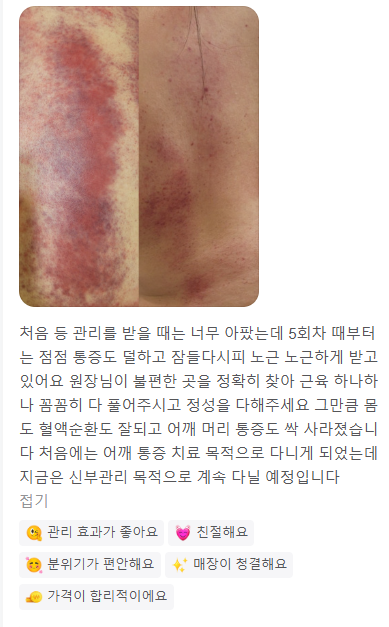 수앤테라피 이미지