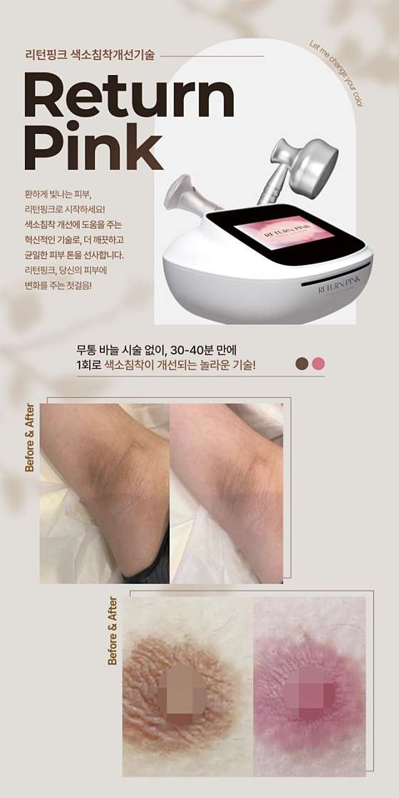 플라즈마 에스테틱 이미지