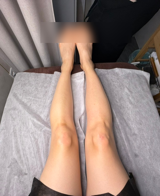 로베리왁싱 이미지