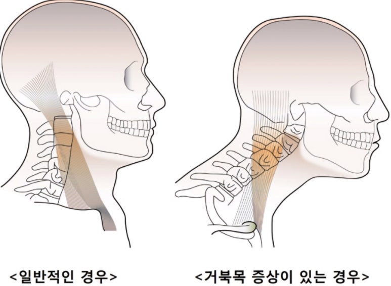 문샵 이미지