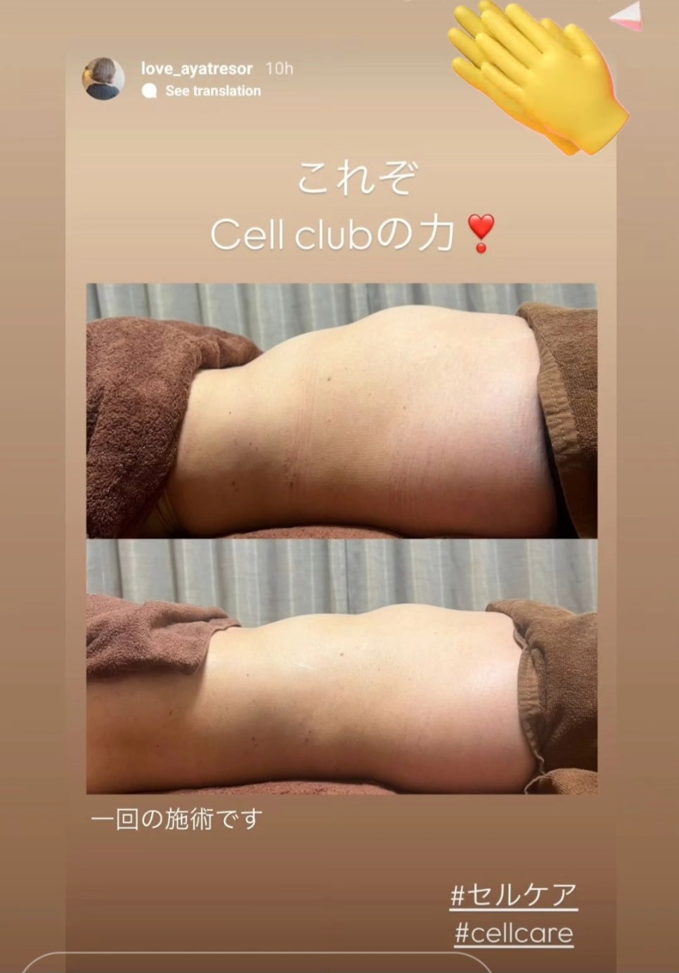 닥터시스 셀클럽 이미지