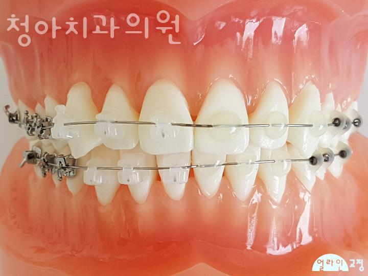 청아치과의원 이미지
