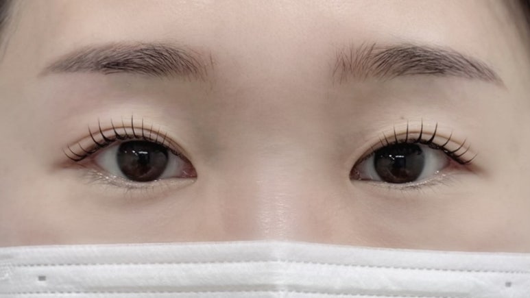 멜트브로우 이미지