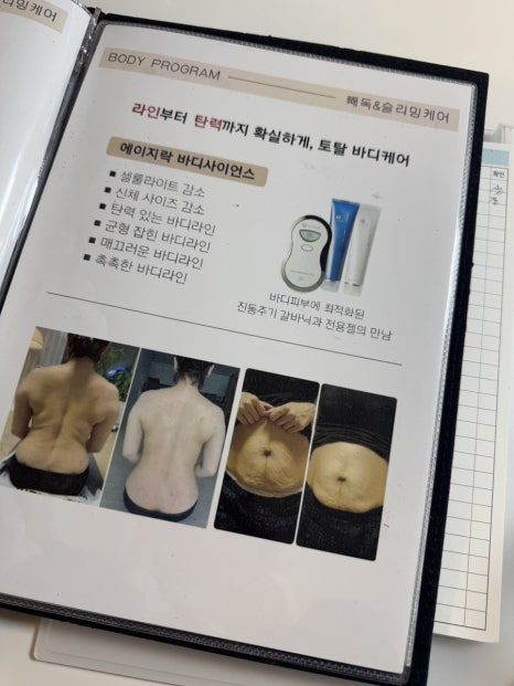 미스킨바디 이미지