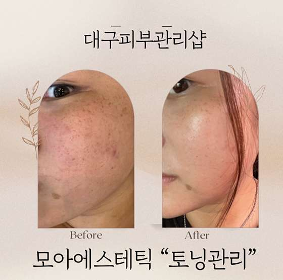모아에스테틱 이미지